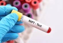 8 Things You Should Know About NIPT: The Non-Invasive Prenatal Test