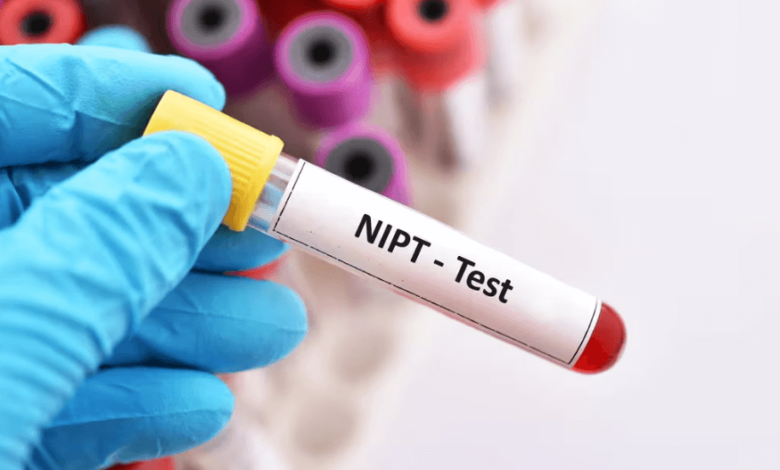 8 Things You Should Know About NIPT: The Non-Invasive Prenatal Test
