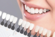 4 Cosmetic Dentistry Trends Shaped By Social Media Influencers
