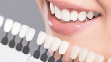4 Cosmetic Dentistry Trends Shaped By Social Media Influencers